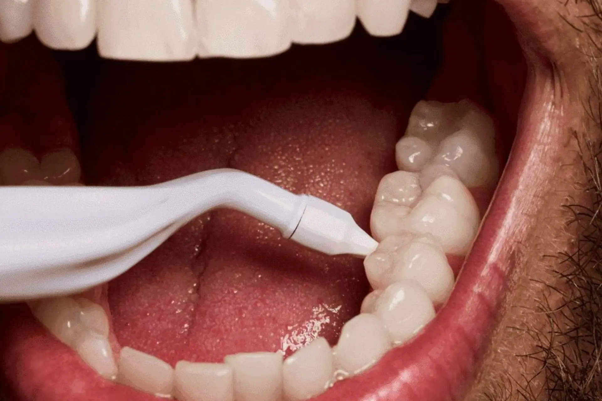 Stimmie Reusable Toothpick 3